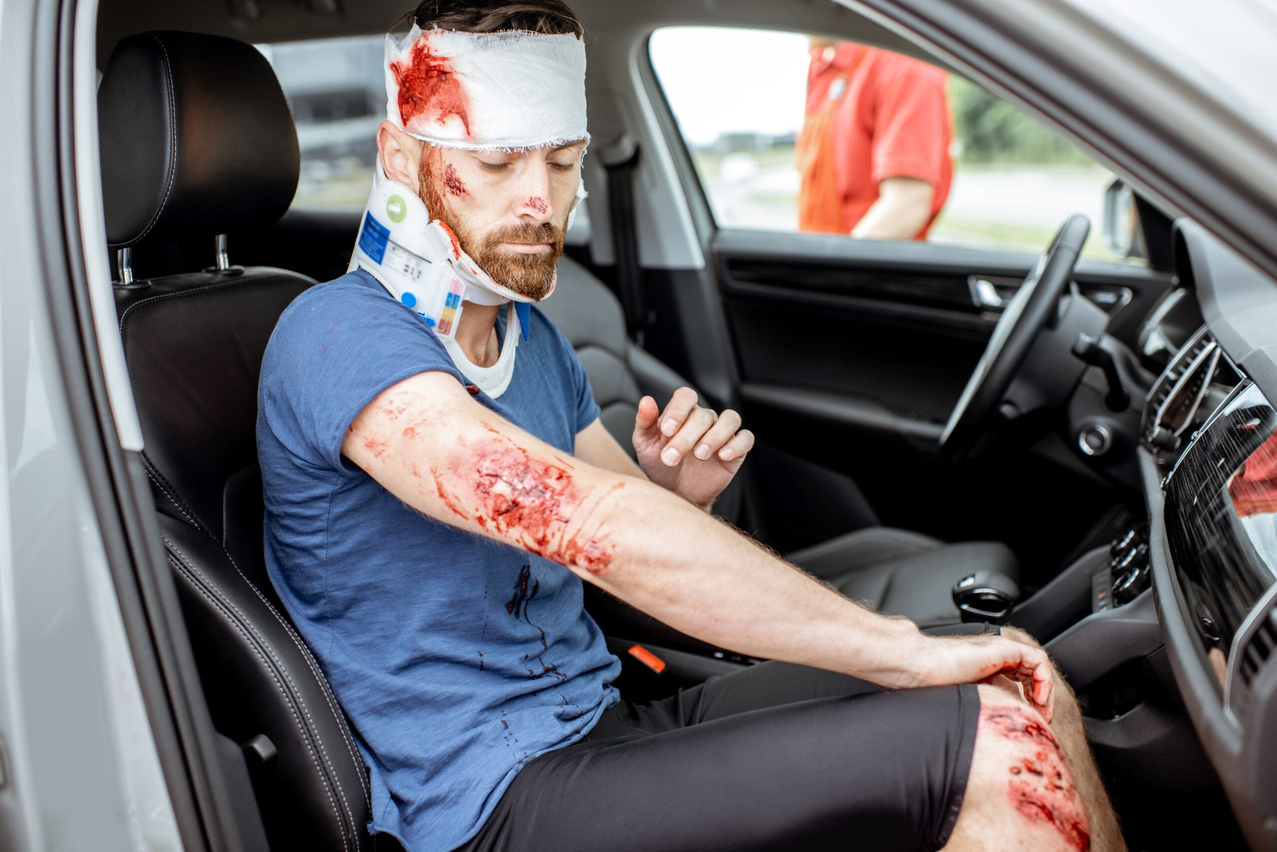 Five Things You Didn't Know About Accident Claim