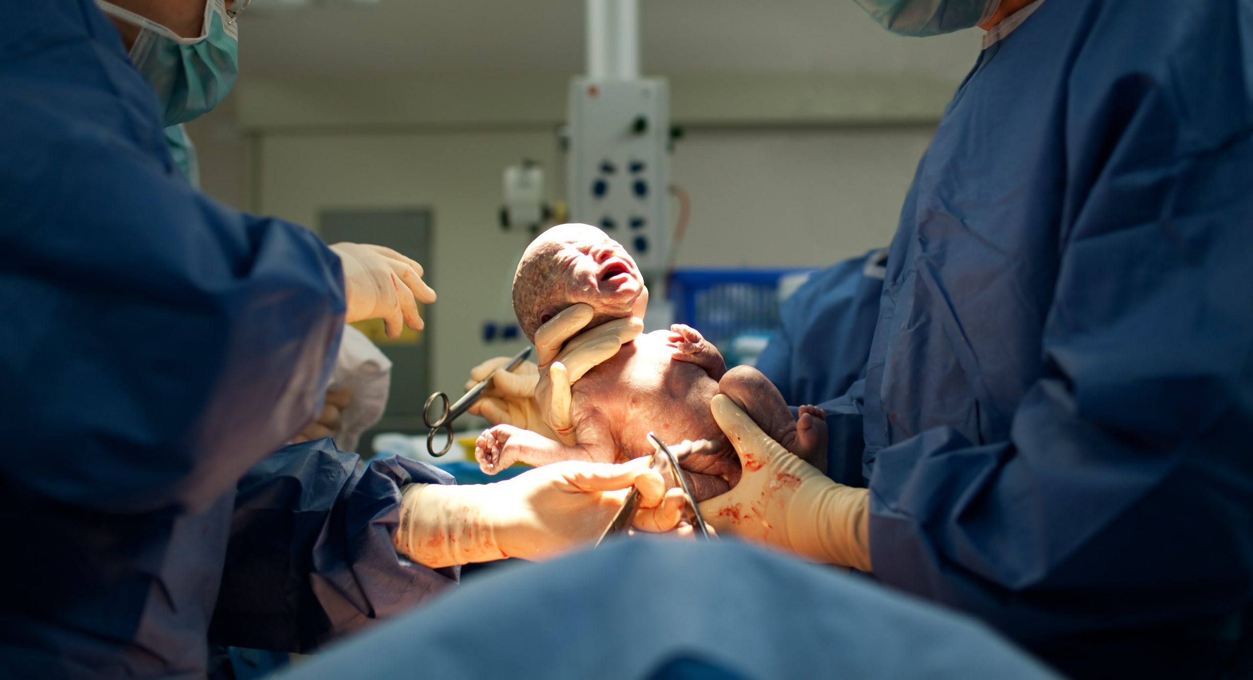baby-being-born-via-caesarean-section-20